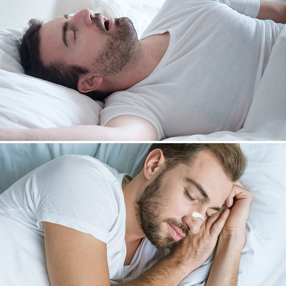 Магнітний розширювач для носа, 30 штук, Білий / Магнітні смужки для покращення дихання / Антихроп для носа